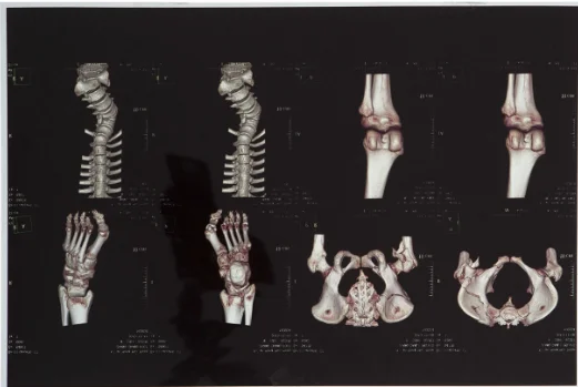 Hoge helderheid medische röntgenfilm FUJI DIHT 14*17in Laser Dry Imaging Film 1