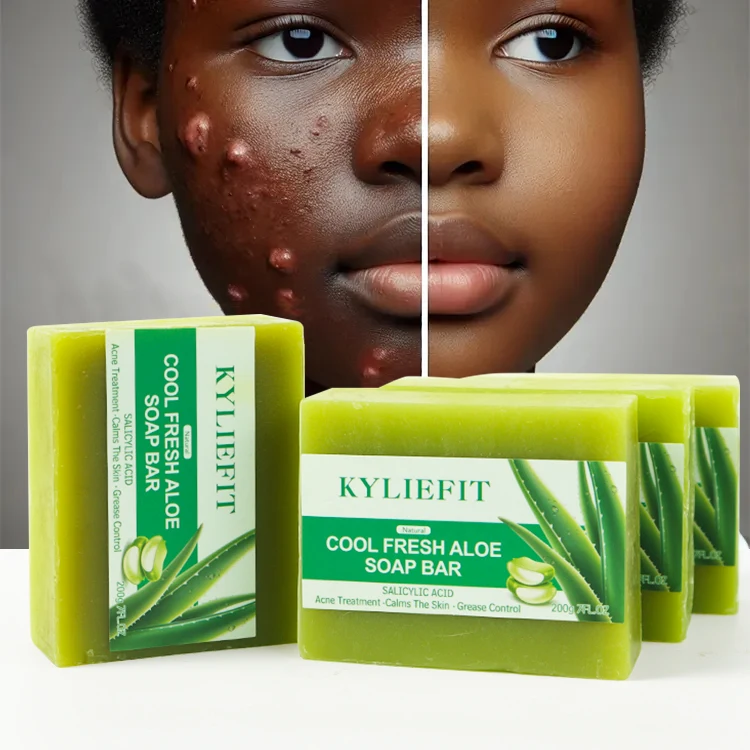 Customizable Handmade Aloe Vera Soap Gentle Cleansing Salicylic Acid  Whitening Face Anti Acne Soap for the Skin