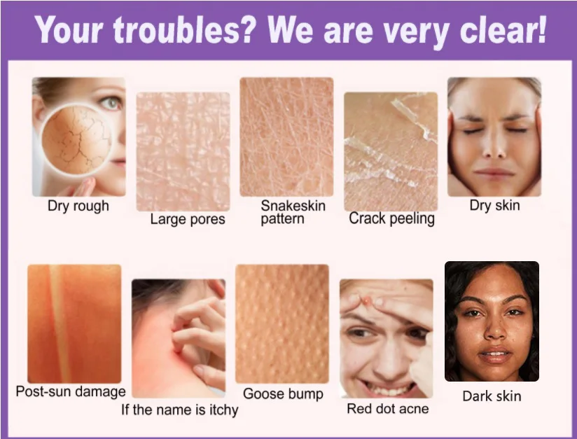 
 OEM логотип клиента против старения удаление морщин взбитое масло увлажняющий крем натуральный женский лосьон для тела  