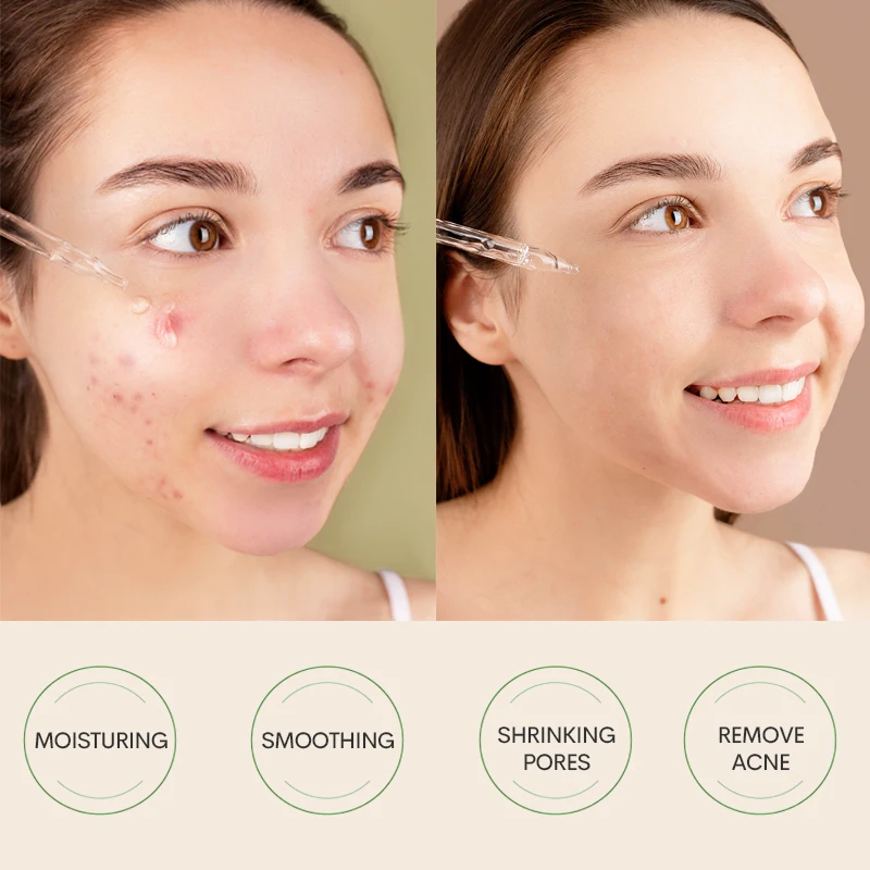 Private Label Oem 5 In 1 Facial Serum Brightening Dark Spot Anti Aging