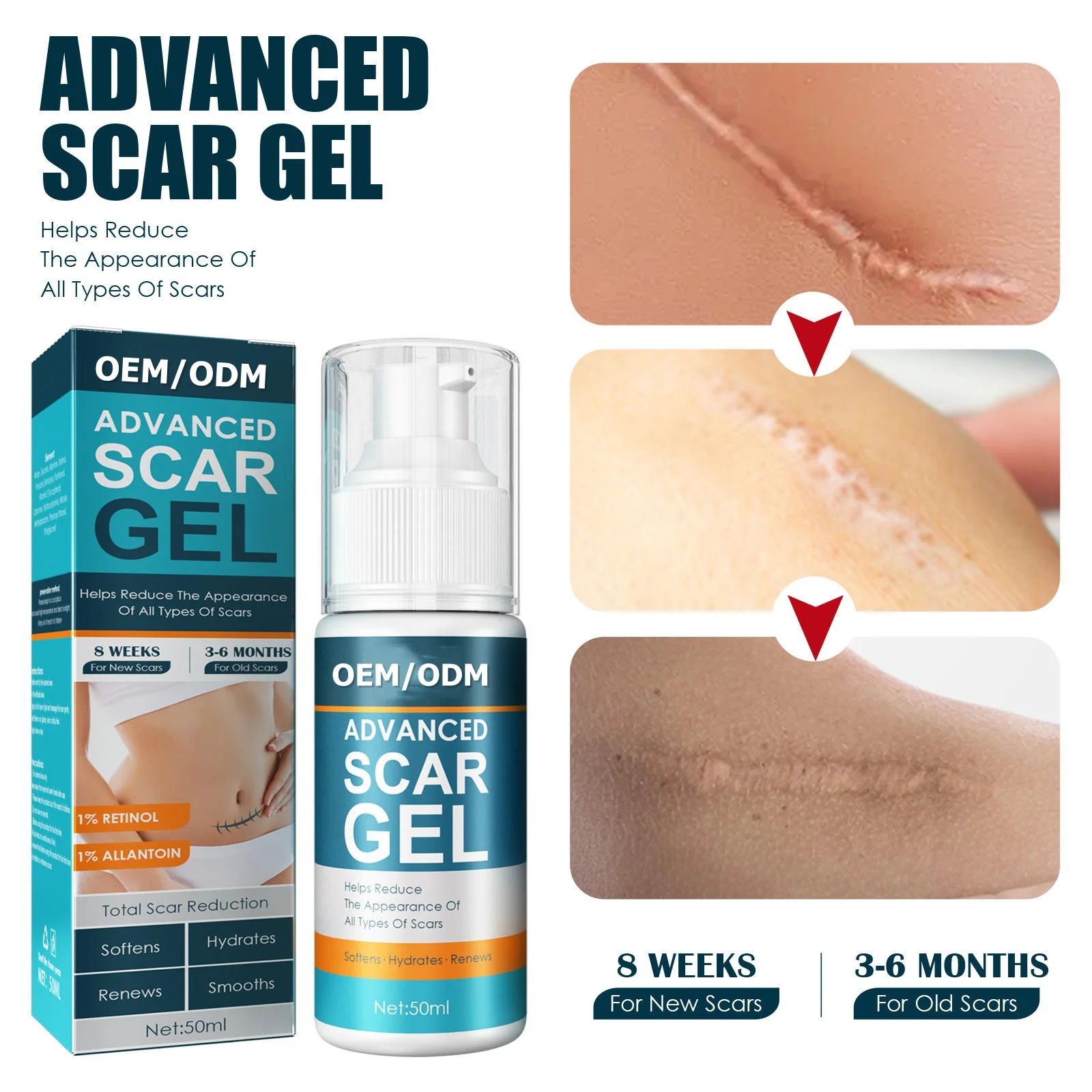 Wholesale Scar Gels for Beauty & Personal Care Lightening Acne Marks Removing Surgical Scars Repairing Scars