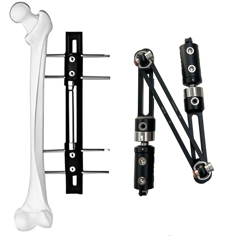 Assured Quality External Fixation Device Orthopedic Surgical Instruments Knee Joint External Fixator Orthopedic Surgical Fixator