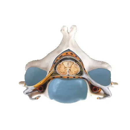 Model of Enlargement of Spinal Cord and Spinal Nerve in the Fifth Cervical Spine