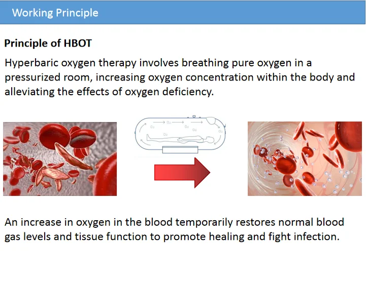 Portable Hyperbaric Chamber Oxygen Concentrator 5l O2 Therapy Near Me