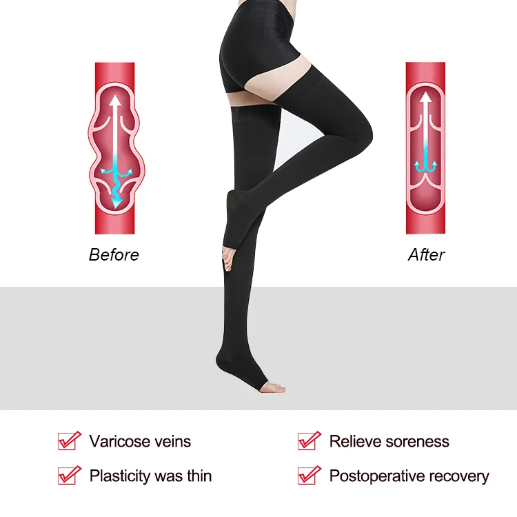 Enerup Custom Nylon 15-20mmhg Open-toe Thigh High Medical Compression Socks Rebound Medical Compression Stockings