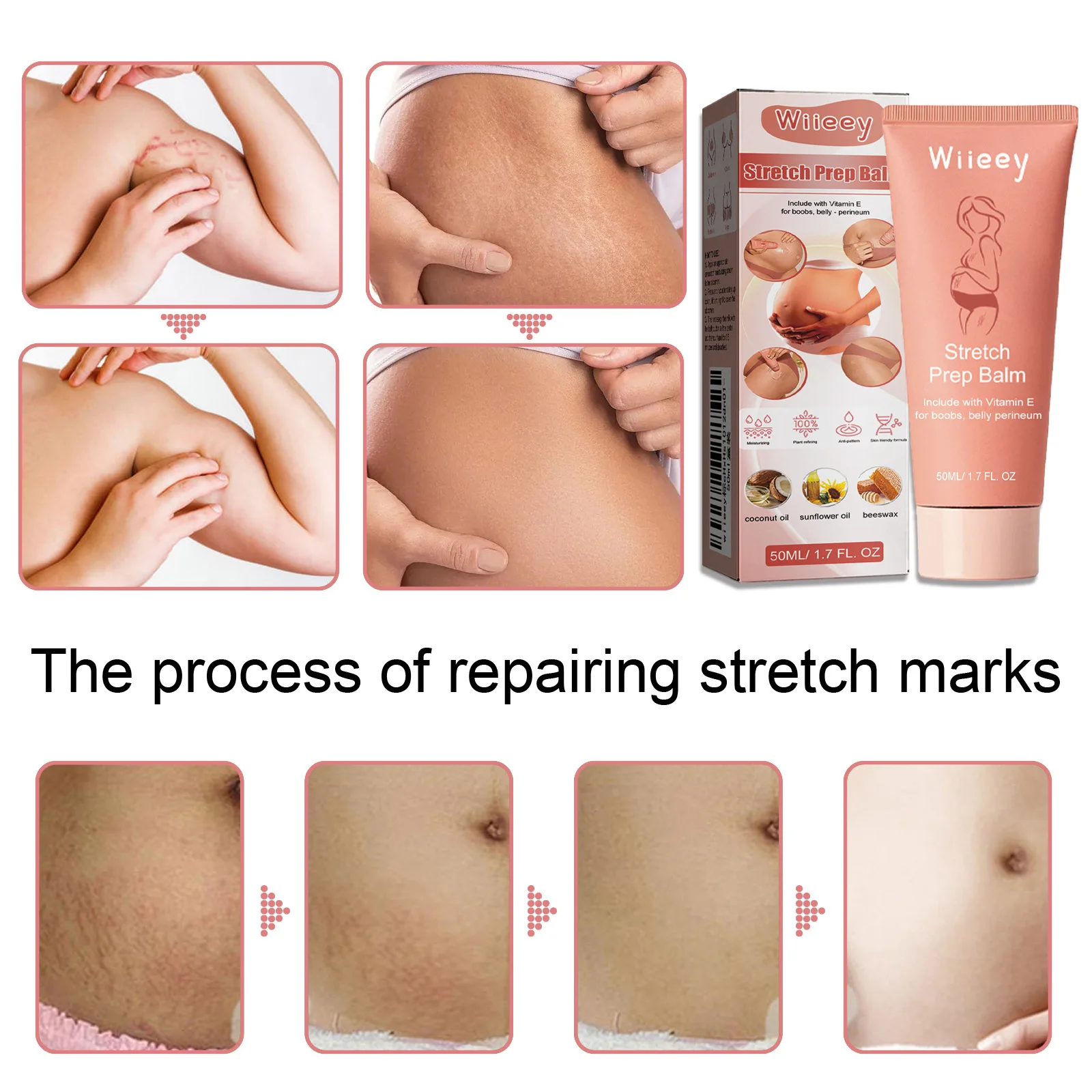 Hot Sale Vegan Stretch Marks Removal Cream Postpartum Body Care Repair Firming Stretch Marks Cream