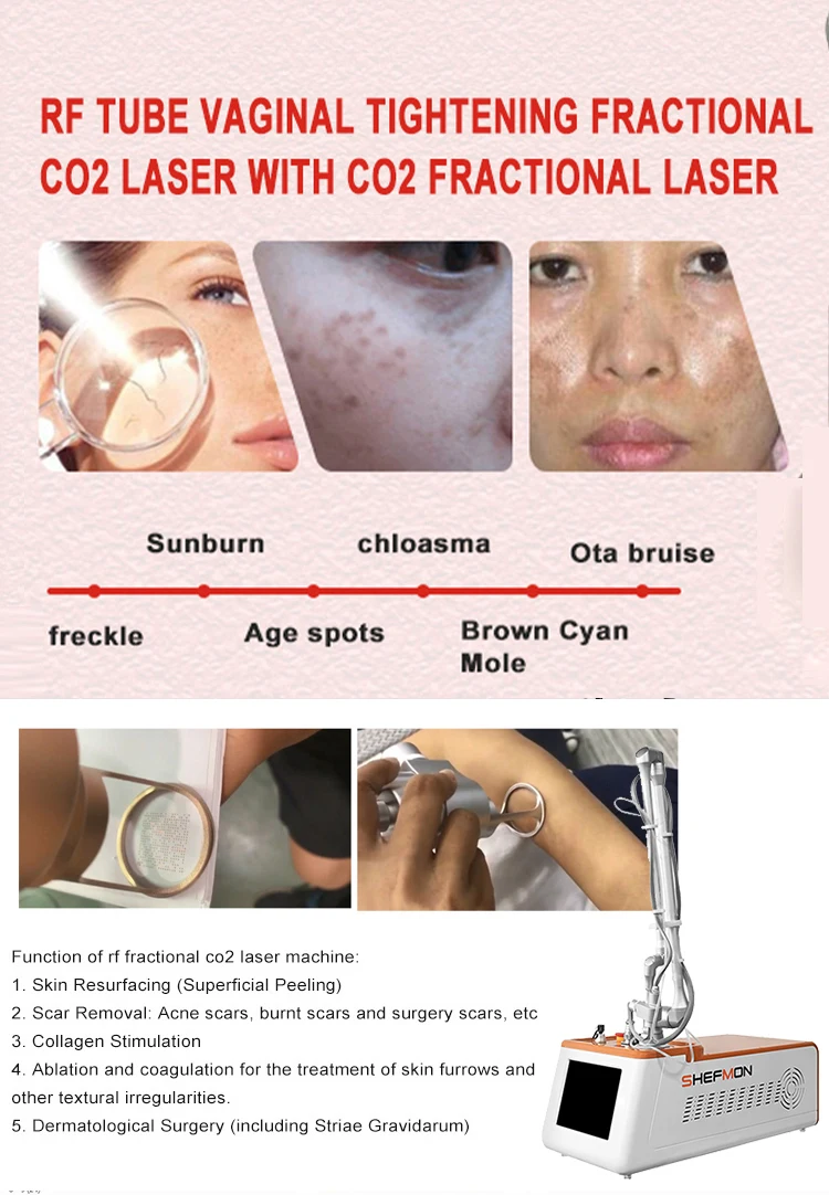 Запечатанное лазерное устройство, имитируемое с помощью лазерной машины с постоянным током CO2 - расстояние 0,1-2,6 мм 1