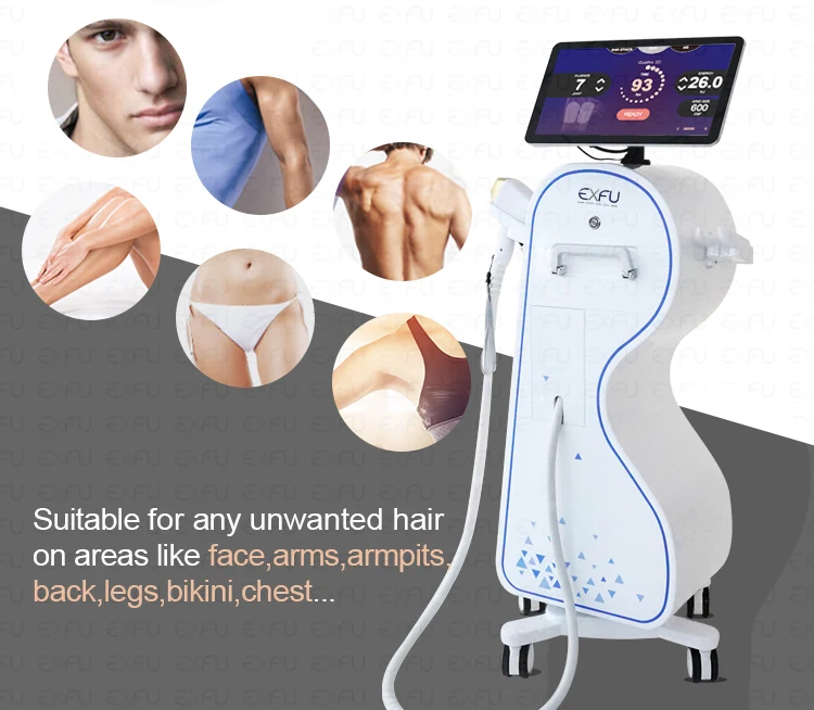 Máquina láser de olas ice plus, depilación de diodo, 808nm, 808