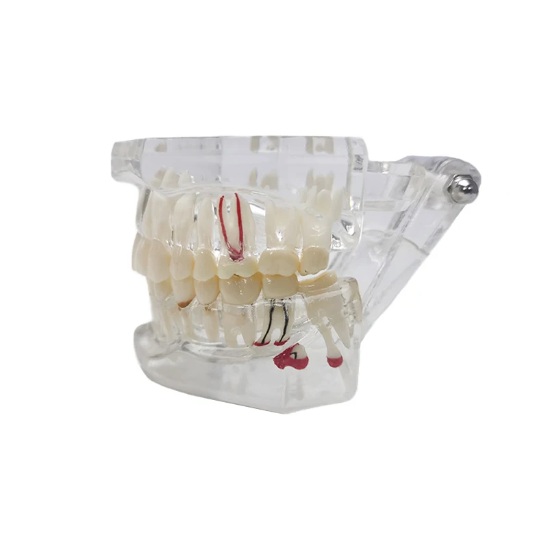 Прозрачная модель зубов для коррекции полости рта съемный имплантат дисплей ногтей обучающая