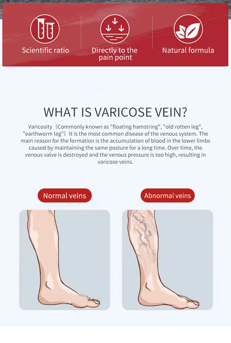 Varicose Veins Patch 2024 Medical Varicose Compression Plaster For ...