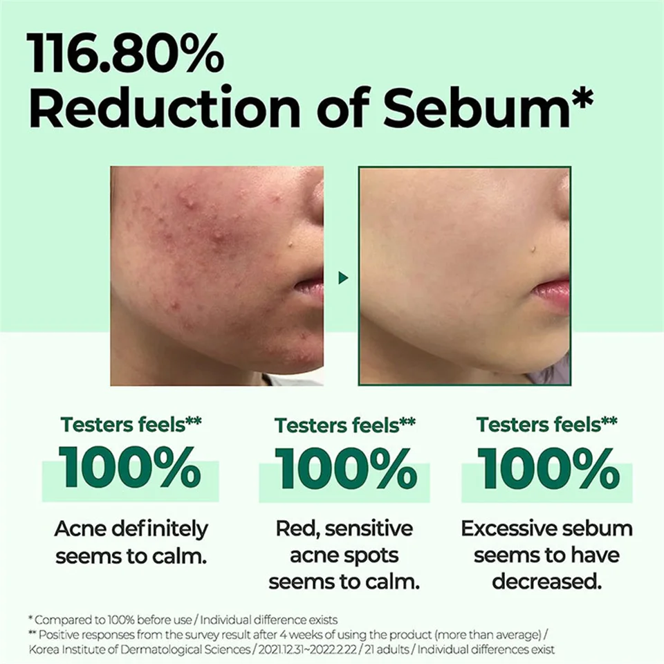 Some Aha Bha Pha 30 Days Miracle Toner 150ml Facial Toner Serum