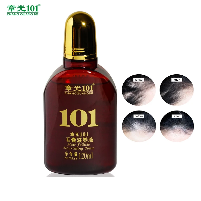 
 Профессиональный высокоэффективный тоник для роста натуральных волос для лечения повреждения волос  