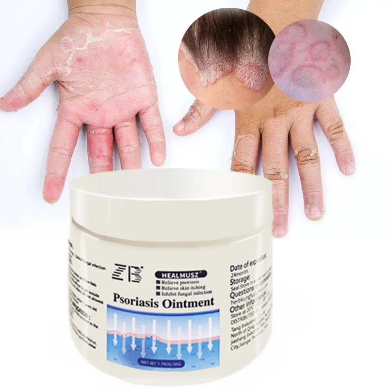 Alibaba com ZB Psoriasis Cream - H0c1b3405fb714b4b8f1f1a7cfaf020b1i