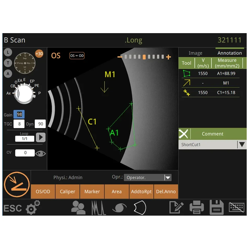 International Medical Certified Ultrasonic Optical Instruments Retiwave-1000 Ophthalmic AB Scan Ultrasound Machine