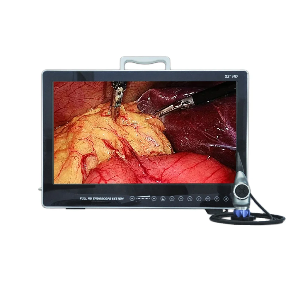 Ikeda Fhd 1080p Ykd-9122 All-in-one 22 Inch Medical Endoscope Camera System  Portable Endoscopy Medical Equipment - Buy 1080p Cmos Portable Arthroscopy  Endoscope Camera Ent Endoscopy Imaging