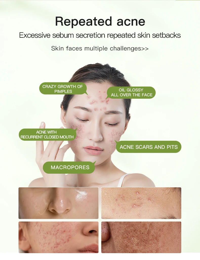 Private Label Icesea Moisturizing Tighten Australian Tea Tree Plant Extract Essential Oil Purifying Facial Face Cream Skin Care(pic2)