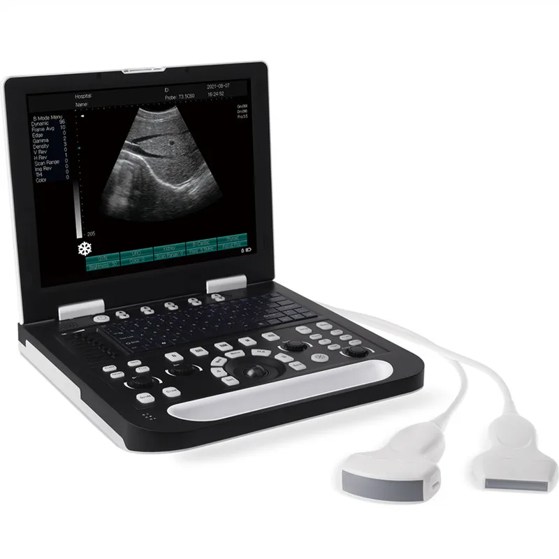 High Quality Hospital Use Portable All Digital Laptop Ultrasound Machine With Dual Probe Interface