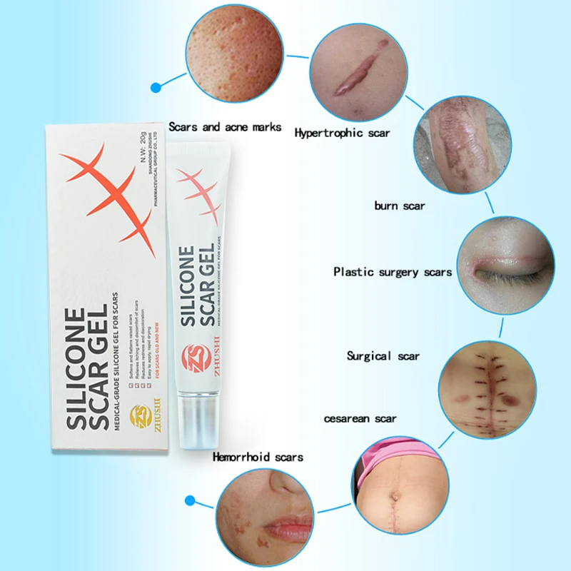 Scars Care Scar Sheets Silicon Gel Sheet Oem Silicone Scar Gel Sheet