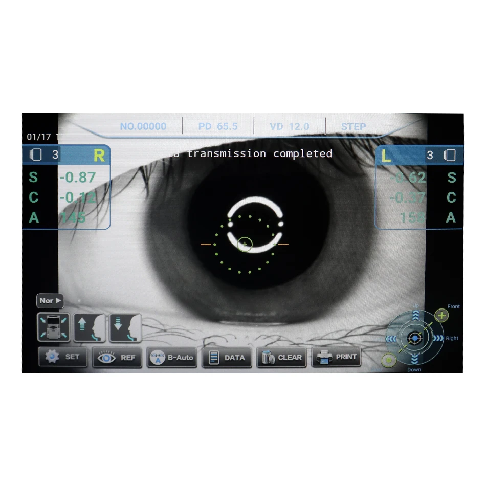 High Quality 3D Full Automated RMK 800 3D Auto Tracking Refractometer Auto Refractometer With Keratometer