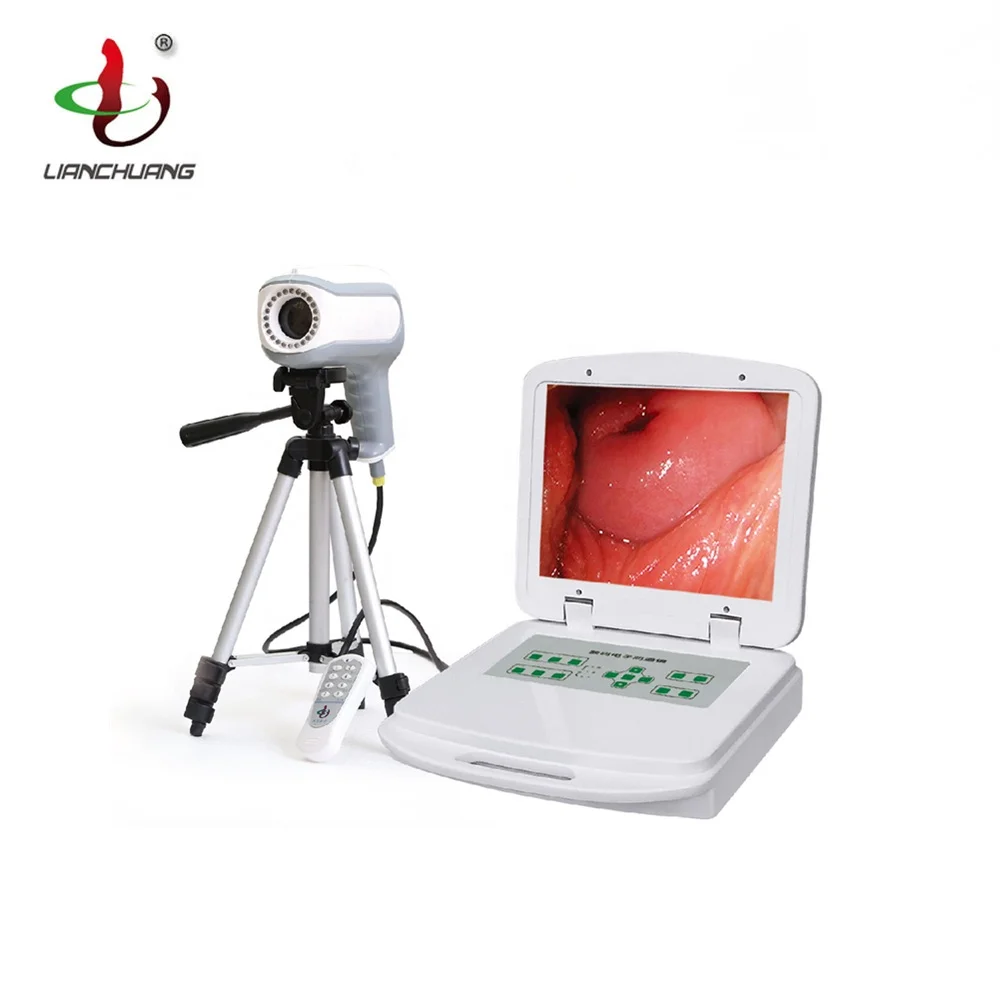 Camera ccd sony portable digital video electronic colposcope for gynecology