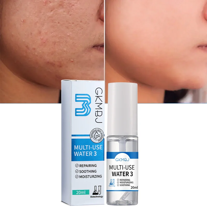 Microbial Fermentation Skin Cares,Anti Age Rough Wrinkle Hydrolyzed