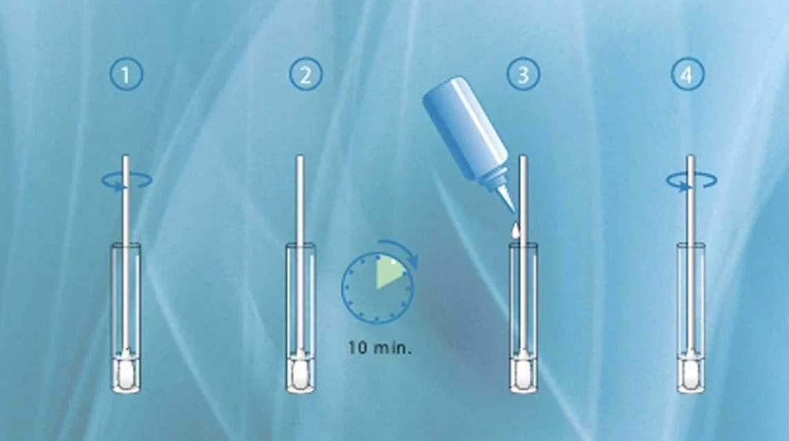 Fast Bacterial Vaginosis Test Kit Plastic Material - Buy Bacterial ...