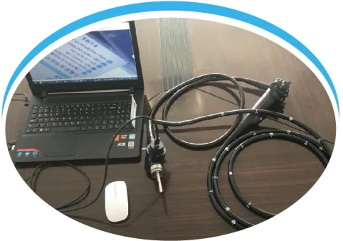 Flexible Video Portable USB Ureteroscope endoscope with CMOS 1,00,000 pixels and USB Colonoscope endoscope can provide OEM