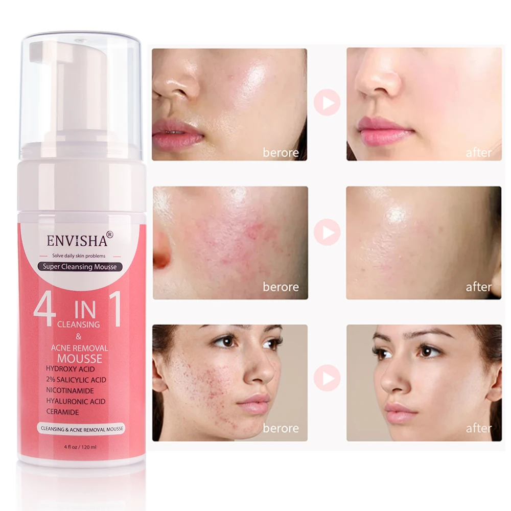 Private Label 4 in 1 Exfoliating Lightening Men Women Oily Skin Face Wash Acne Treatment Hydrating Deep Cleansing Foam Mousse