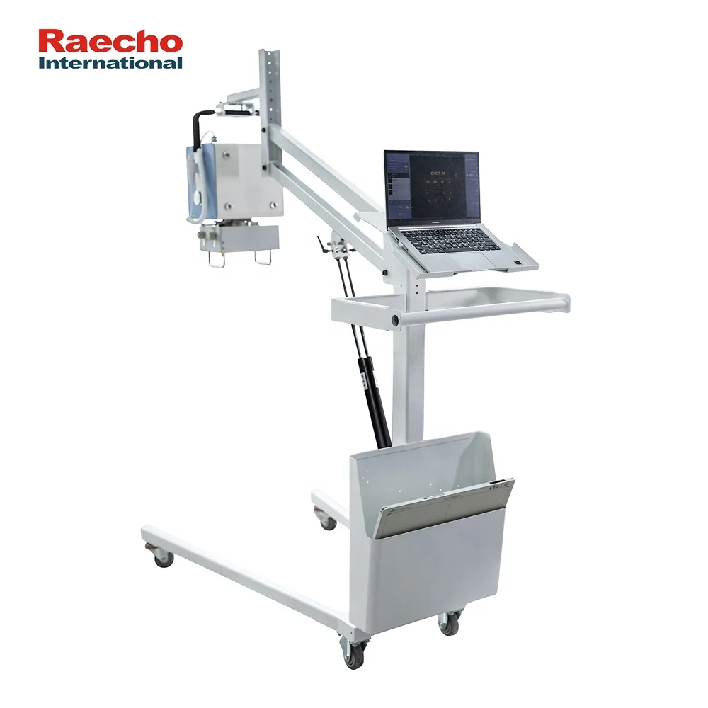 High Frequency Inverter Technology Good Images Quality X Ray Viewer