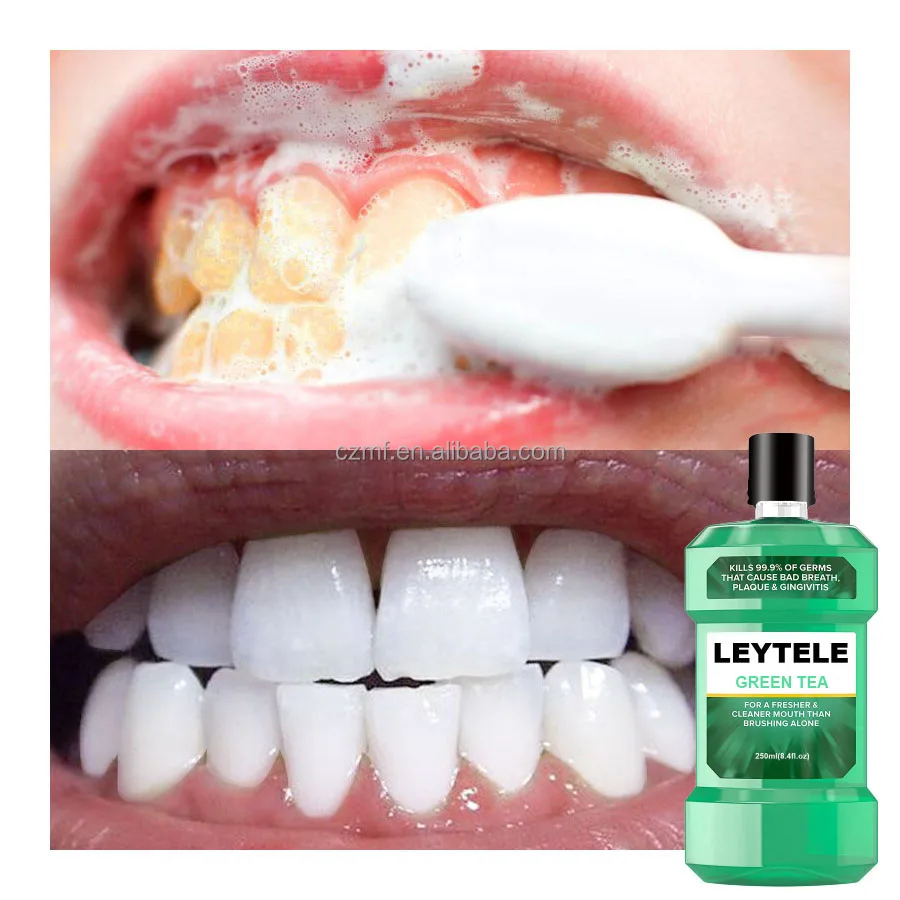 Private Label 250ML Natural Organic Teeth Whitening Oral Care Cleans Your Teeth Green Tea Mouthwash