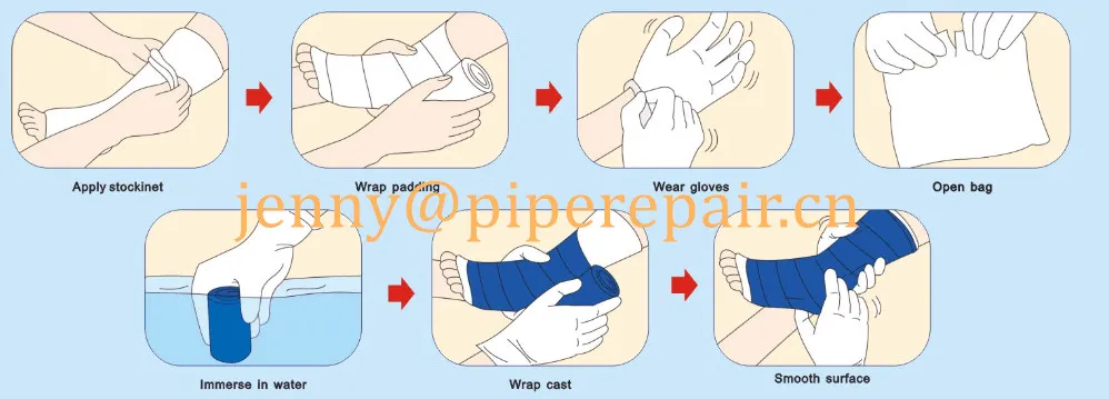 High Quality Hospital Disposable Medical Use Waterproof Polyurethane Orthopedic Fiber Cast Bandage