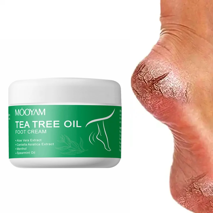 Best Sellers Urea Cream Foot care Foot Repair Cream For Rough Thick Dry ...