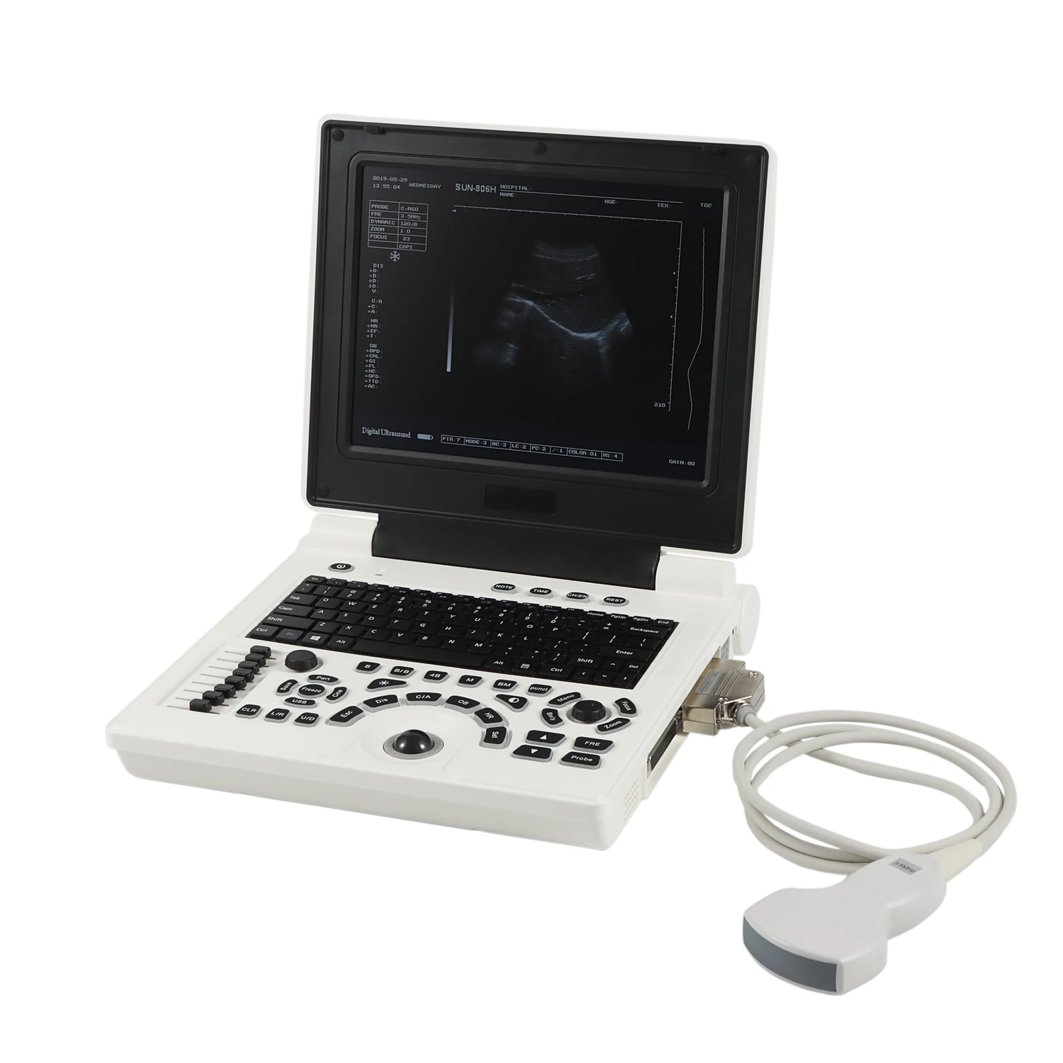 Portable Black and White Ultrasound Machine with High-Resolution Imaging  and Rechargeable Battery