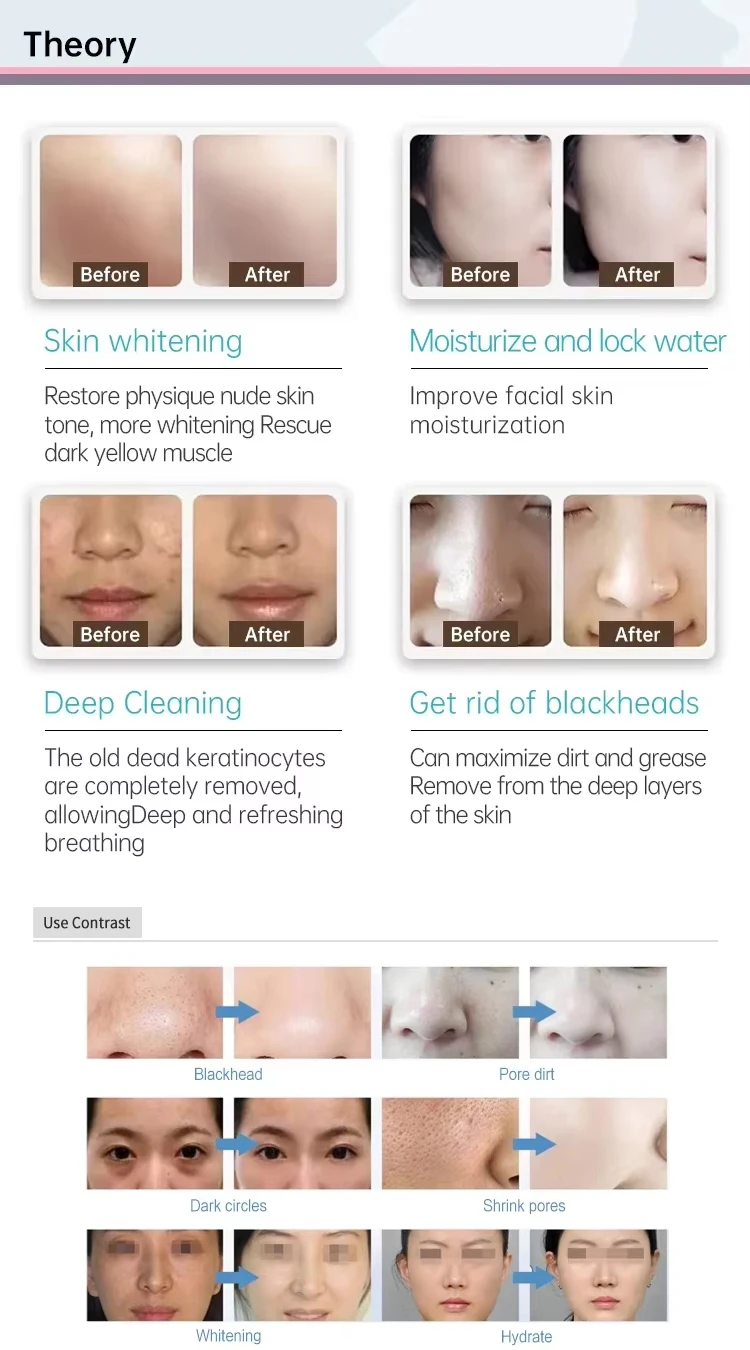 2026 Hydrodermabrasion Facial Machine 2025 Co2 Oxygen Bubble Facial Machine Hydra Dermabrasion Facial Cleaning Beauty Machine