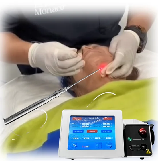 980nm 1470nm Diode Laser Face Endolaser Fiberlift Endolaser Diodo 980 nm  1470 Portatil Liposuction Endolaser Lift Machine