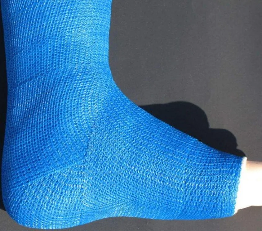 Синтетический гипс. Fiberglass Cast Gips. Bandajlar.