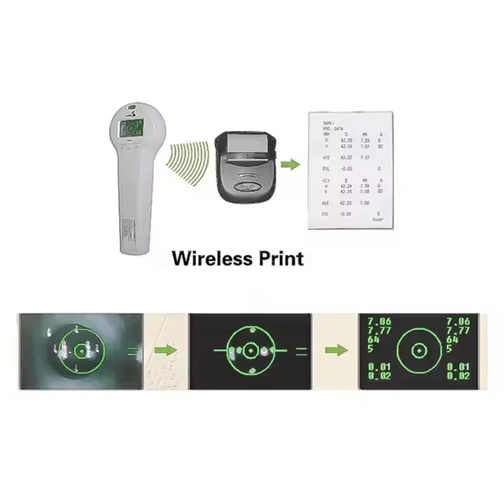SW-100 Handheld Auto-Reflective Keratometer: Portable and Accurate Device for Measuring Corneal Curvature
