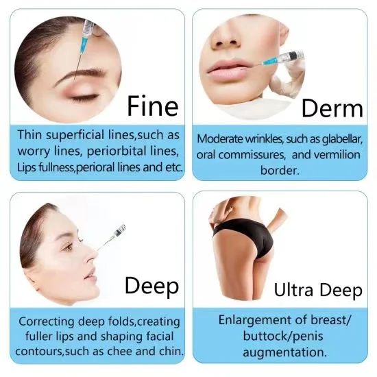 Hereme lips augmentation nose cheek HA gel injection cross-linked hyaluronic acid dermal filler for lip injections
