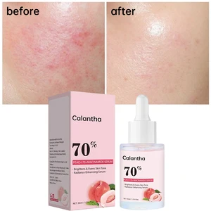 Private Label Niacinamide Hyaluronic Acid Liquid Serum Brightening and Moisturizing for Dry and Sensitive Skin