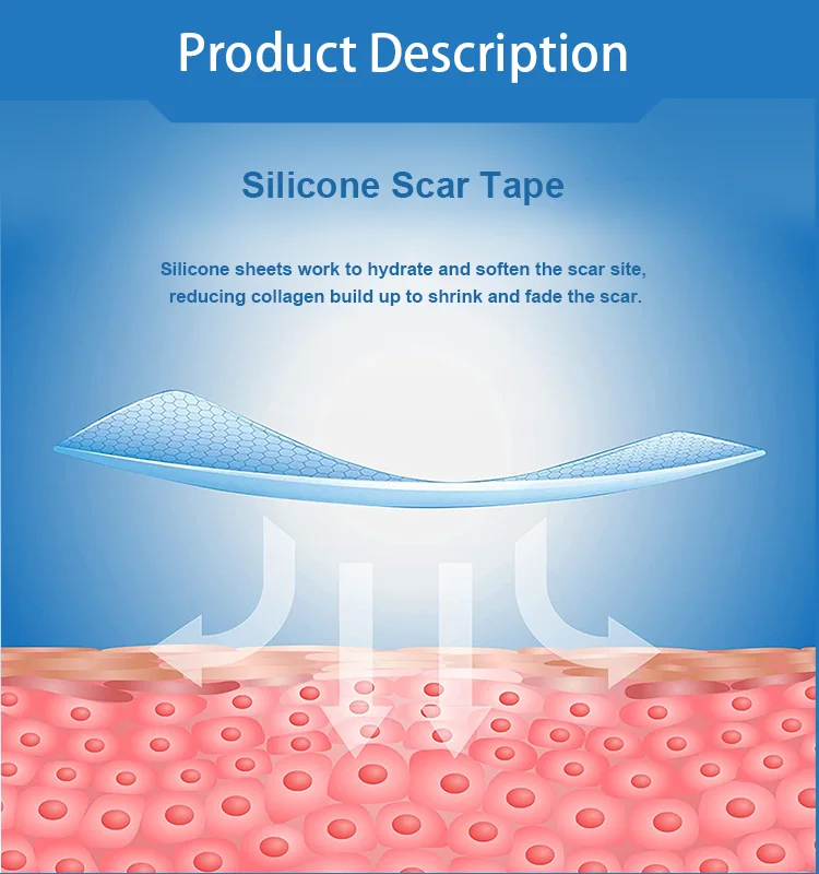 Factory Customized Private Label Medical Blue Pink Transparent Skin