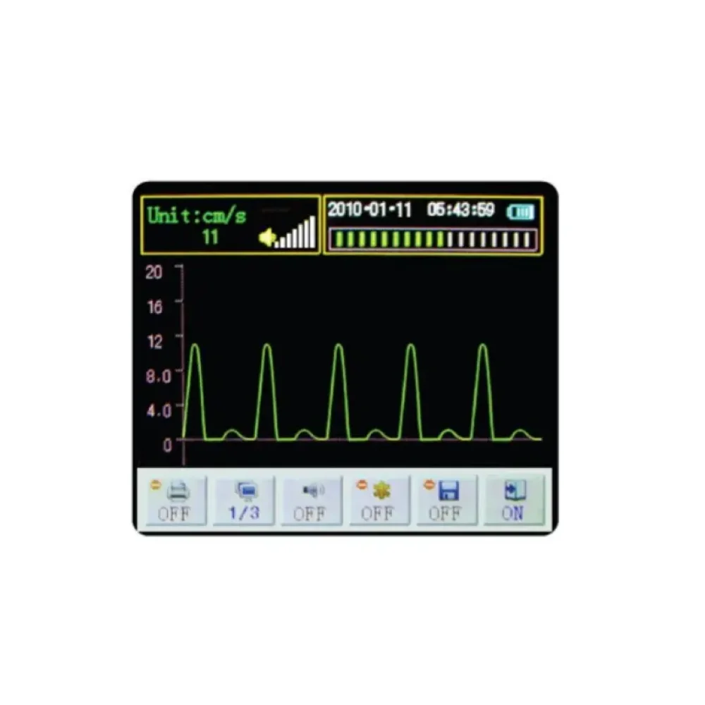 Doppler Vascular Best 8MHz Probe Doppler Vascular Portable Price Most Standard Hand Held Doppler Vascular for Medical