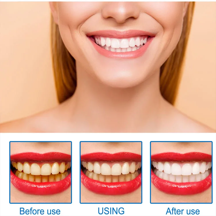 EELHOE Teeth Whitening Essence Cleaner Improve Yellow Teeth Stain Remover to Clean Tooth Stains and Tartar
