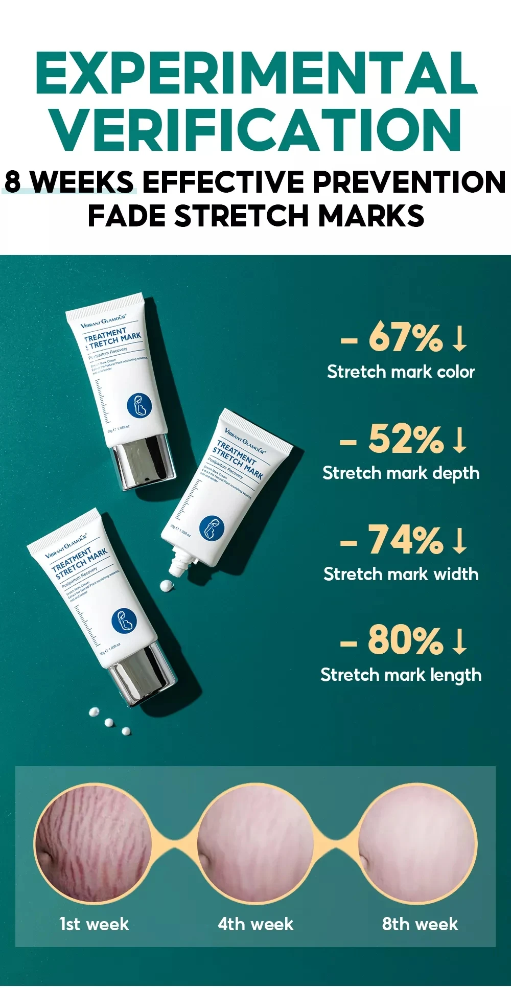 VIBRANT GLAMOUR Pregnancy Treatment Stretch Marks Cream 30g