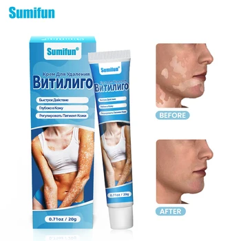 20g Skin Scar Removal Cream Treatment  Reduce Stain  Deep Repair Body Health Ointment