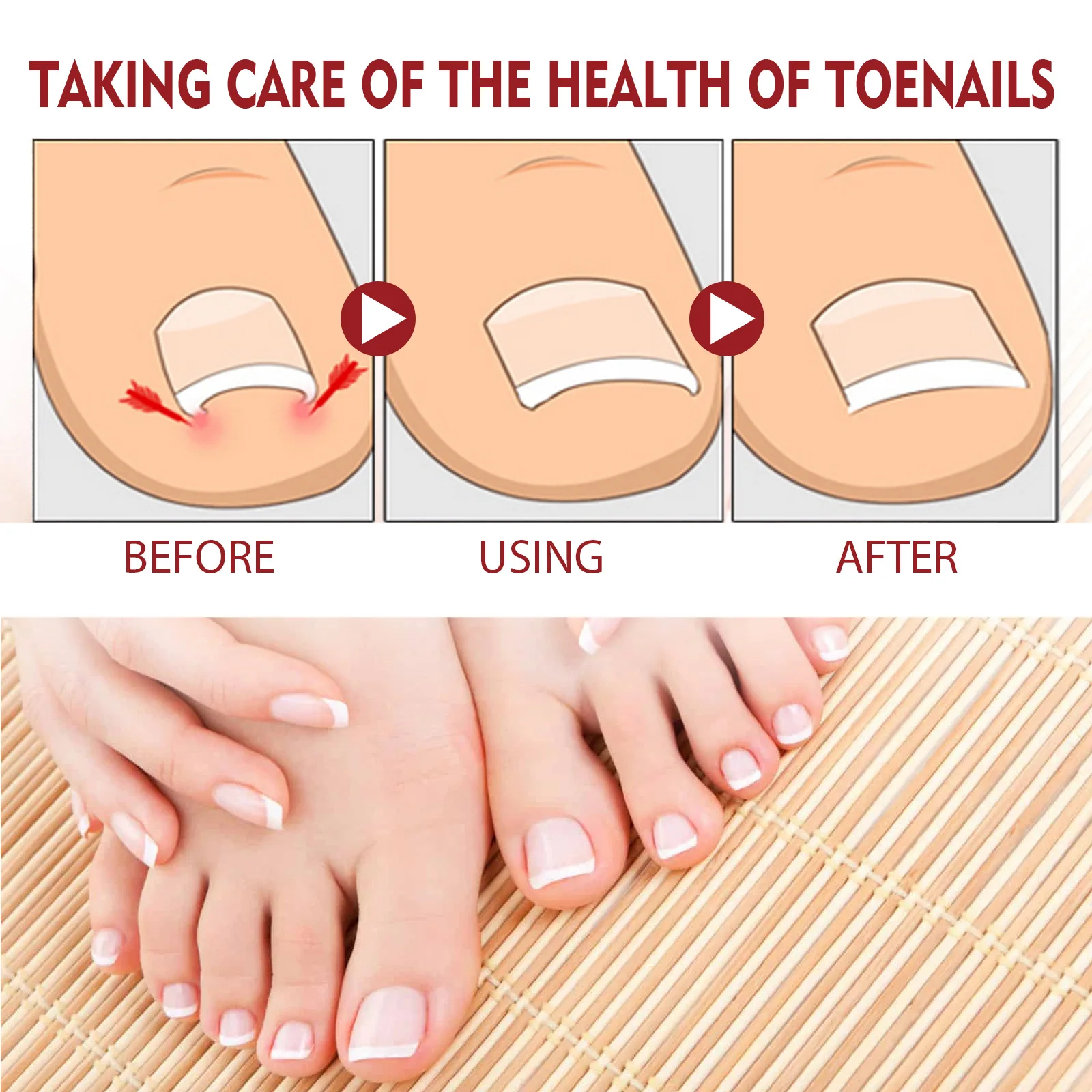 Nail Renewal Extra Strength Fungus Toe Fingernails Repair Liquid Renew Damaged Broken Nail 7 Days Nail Fungus Treatment