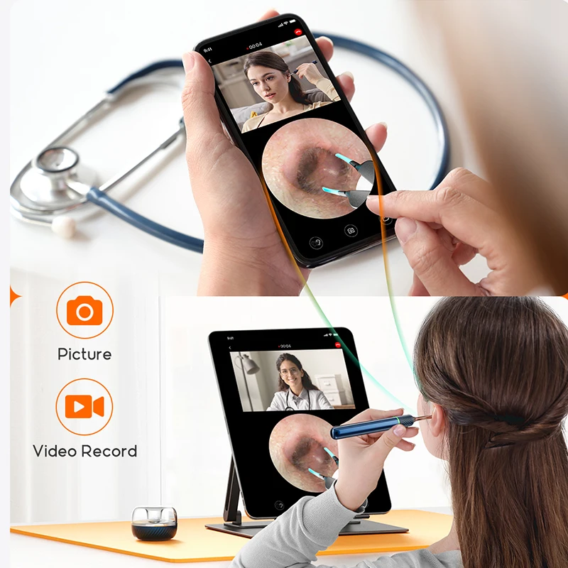 For Bebird Note5 Pro Smart Visual Ear Cleaner Wireless Otoscope Digital Endoscope Safe Ear Pick Tool for Ear Wax Removal