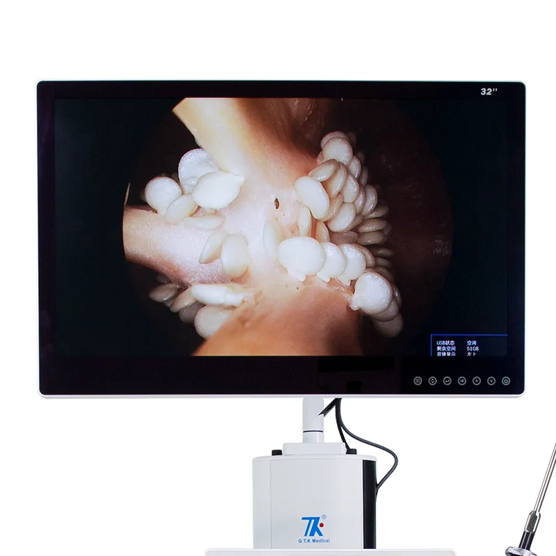 TOP1 Laparoscopic Instruments Ent Endoscope Camera System/endoscope Medical System Video Duodenoscope