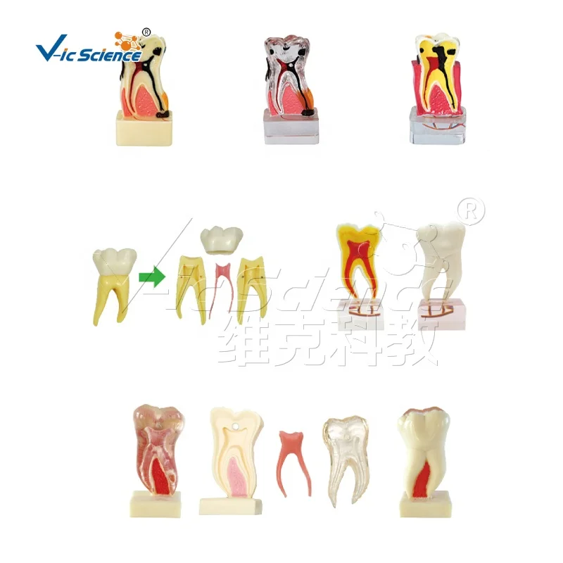 Caries Model Practice Teeth - Nissin Dental Skeleton Model for