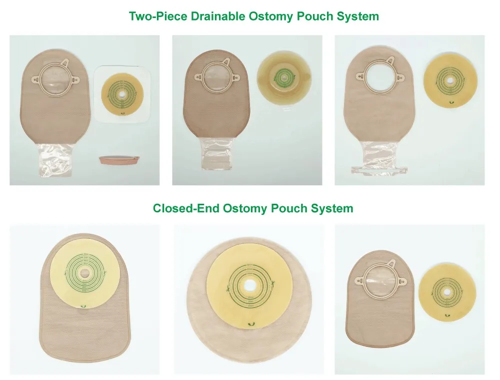 Trummed One Piece Stoma Bag 1 Piece Drainable Stoma Bag With Irrigation