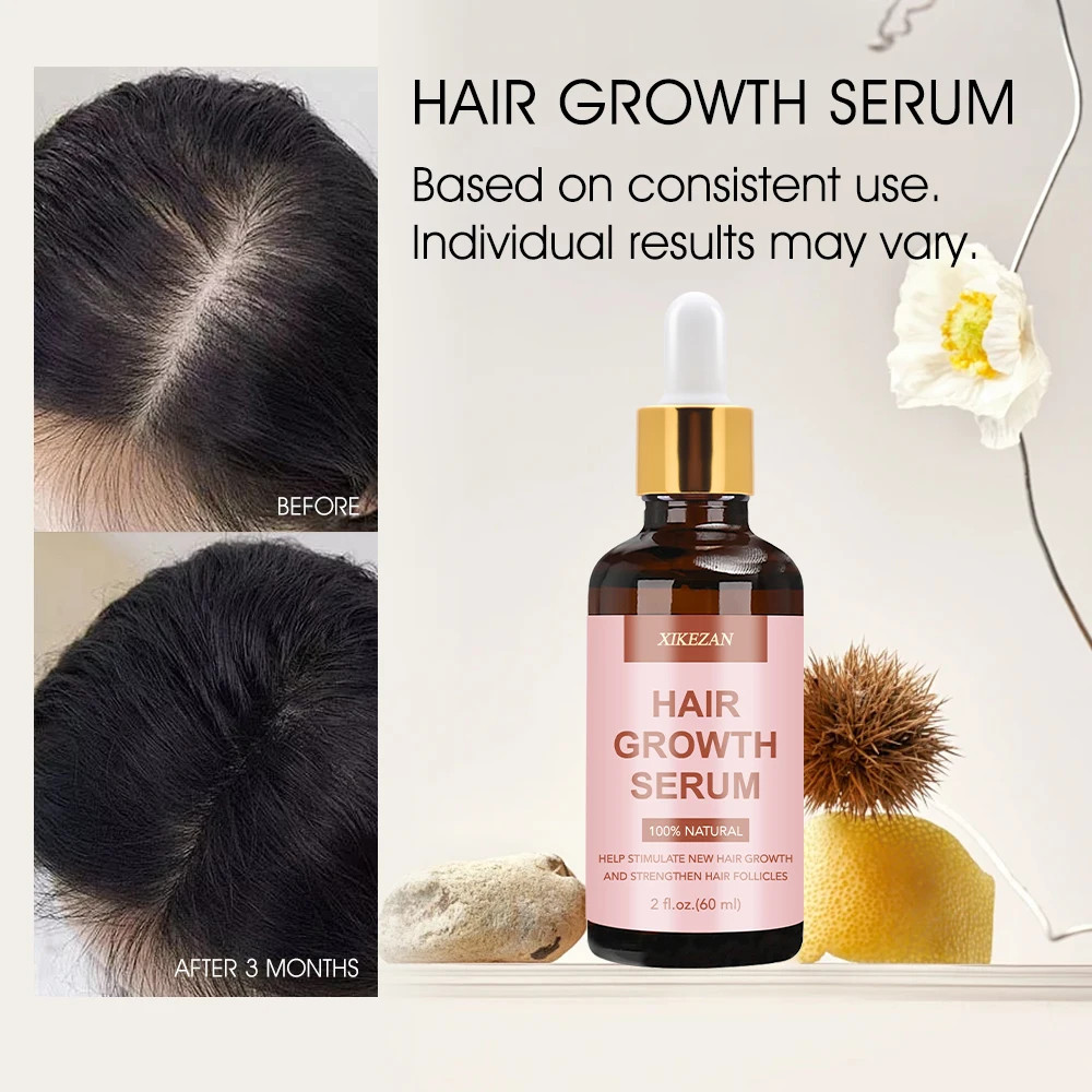 OEM Luxury Hair Scalp Serum - Vegan Caffeine & Shea Moisture